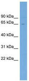 Zinc Finger BED-Type Containing 8 antibody, TA344705, Origene, Western Blot image 