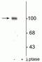 Glutamate Ionotropic Receptor AMPA Type Subunit 1 antibody, P02677-1, Boster Biological Technology, Western Blot image 