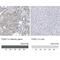 Forkhead Box C1 antibody, NBP1-89025, Novus Biologicals, Immunohistochemistry paraffin image 