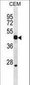 WNT Inhibitory Factor 1 antibody, LS-C160623, Lifespan Biosciences, Western Blot image 