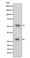 Adhesion G Protein-Coupled Receptor E5 antibody, M02982-1, Boster Biological Technology, Western Blot image 