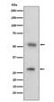 CD97 antigen antibody, M02982-1, Boster Biological Technology, Western Blot image 