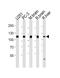 Ubiquitin Specific Peptidase 5 antibody, M04550, Boster Biological Technology, Western Blot image 