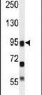 Arachidonate Lipoxygenase 3 antibody, PA5-23953, Invitrogen Antibodies, Western Blot image 