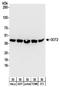 Glutamic-Oxaloacetic Transaminase 2 antibody, NBP2-32241, Novus Biologicals, Western Blot image 