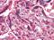 NME/NM23 Nucleoside Diphosphate Kinase 1 antibody, GTX83325, GeneTex, Immunohistochemistry paraffin image 