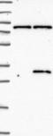 AlkB Homolog 7 antibody, NBP1-81231, Novus Biologicals, Western Blot image 