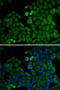 Transcription factor E2F6 antibody, 22-034, ProSci, Immunofluorescence image 