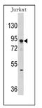 DNA Methyltransferase 3 Alpha antibody, AP11050PU-N, Origene, Western Blot image 