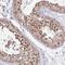 Inositol-Trisphosphate 3-Kinase C antibody, NBP2-49068, Novus Biologicals, Immunohistochemistry paraffin image 