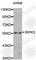 Receptor Interacting Serine/Threonine Kinase 3 antibody, A0665, ABclonal Technology, Western Blot image 