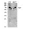 Mitogen-Activated Protein Kinase Kinase Kinase 7 antibody, LS-C386310, Lifespan Biosciences, Western Blot image 