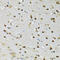 Cyclin Dependent Kinase 6 antibody, 16-567, ProSci, Immunohistochemistry frozen image 