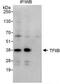 General Transcription Factor IIB antibody, NBP1-49981, Novus Biologicals, Western Blot image 