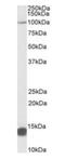 Tripartite Motif Containing 71 antibody, orb20522, Biorbyt, Western Blot image 