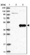 Amine Oxidase Copper Containing 1 antibody, NBP1-89067, Novus Biologicals, Western Blot image 