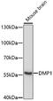 Dentin Matrix Acidic Phosphoprotein 1 antibody, A01984, Boster Biological Technology, Western Blot image 