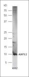 Potassium Voltage-Gated Channel Subfamily A Member 3 antibody, orb184492, Biorbyt, Western Blot image 