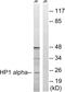 Chromobox 5 antibody, LS-C118344, Lifespan Biosciences, Western Blot image 