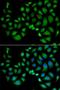 6-Pyruvoyltetrahydropterin Synthase antibody, orb247356, Biorbyt, Immunofluorescence image 