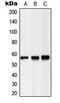 Lipase C, Hepatic Type antibody, MBS821235, MyBioSource, Western Blot image 