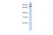 FCH Domain Only 1 antibody, A09023, Boster Biological Technology, Western Blot image 