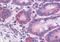 Acyl-CoA Synthetase Long Chain Family Member 4 antibody, NB300-861, Novus Biologicals, Immunohistochemistry paraffin image 