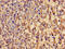 Glutamate-Cysteine Ligase Modifier Subunit antibody, CSB-PA009322LA01HU, Cusabio, Immunohistochemistry paraffin image 