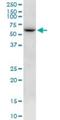 Netrin 5 antibody, H00126147-B01P, Novus Biologicals, Western Blot image 