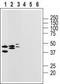 Purinergic Receptor P2Y14 antibody, TA328671, Origene, Western Blot image 