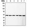 RCC1 And BTB Domain Containing Protein 1 antibody, LS-B13631, Lifespan Biosciences, Western Blot image 