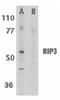 Receptor Interacting Serine/Threonine Kinase 3 antibody, PA5-19956, Invitrogen Antibodies, Western Blot image 