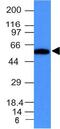 Fascin Actin-Bundling Protein 1 antibody, GTX34718, GeneTex, Western Blot image 