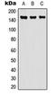 Carboxypeptidase D antibody, LS-C354298, Lifespan Biosciences, Western Blot image 