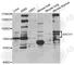BTB Domain And CNC Homolog 1 antibody, A5393, ABclonal Technology, Western Blot image 
