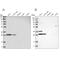Translational Activator Of Cytochrome C Oxidase I antibody, PA5-55043, Invitrogen Antibodies, Western Blot image 