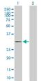 Calponin 2 antibody, H00001265-B01P, Novus Biologicals, Western Blot image 