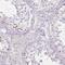 CCCTC-Binding Factor Like antibody, NBP1-89947, Novus Biologicals, Immunohistochemistry frozen image 
