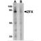 Zinc Finger Protein X-Linked antibody, MBS150081, MyBioSource, Western Blot image 