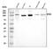 SET Domain Bifurcated Histone Lysine Methyltransferase 2 antibody, A08290-3, Boster Biological Technology, Western Blot image 