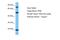 Alkaline Phosphatase, Intestinal antibody, A30225, Boster Biological Technology, Western Blot image 