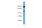 Family With Sequence Similarity 160 Member B1 antibody, A15625, Boster Biological Technology, Western Blot image 