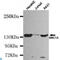 Structural Maintenance Of Chromosomes 1A antibody, LS-C813122, Lifespan Biosciences, Western Blot image 