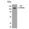 Angiotensin I Converting Enzyme antibody, NBP2-12007, Novus Biologicals, Western Blot image 