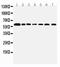 Coactivator Associated Arginine Methyltransferase 1 antibody, PA2263, Boster Biological Technology, Western Blot image 