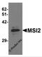 Musashi RNA Binding Protein 2 antibody, 6309, ProSci, Western Blot image 