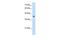 Kynurenine Aminotransferase 3 antibody, GTX47413, GeneTex, Western Blot image 