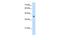 Kynurenine Aminotransferase 3 antibody, GTX47413, GeneTex, Western Blot image 