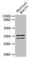 Troponin T2, Cardiac Type antibody, CSB-PA10047A0Rb, Cusabio, Western Blot image 