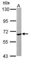 Coenzyme A Synthase antibody, NBP1-32649, Novus Biologicals, Western Blot image 
